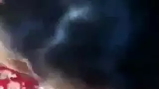 تجميل الوجه بعد اللسان من شاب هندي